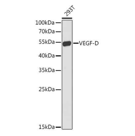 Western Blot - Anti-VEGFD Antibody (A90424) - Antibodies.com