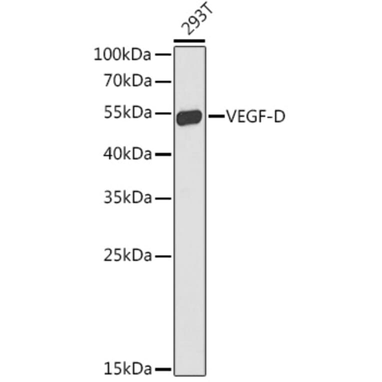 Western Blot - Anti-VEGFD Antibody (A90424) - Antibodies.com
