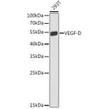Western Blot - Anti-VEGFD Antibody (A90424) - Antibodies.com