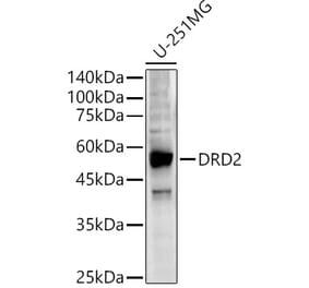 Western Blot - Anti-Dopamine D2 Receptor Antibody (A90425) - Antibodies.com
