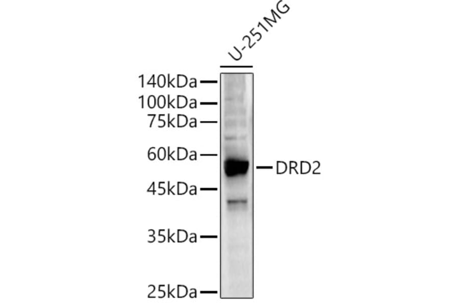 Western Blot - Anti-Dopamine D2 Receptor Antibody (A90425) - Antibodies.com