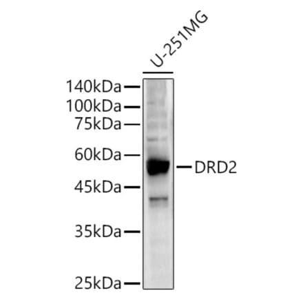 Western Blot - Anti-Dopamine D2 Receptor Antibody (A90425) - Antibodies.com