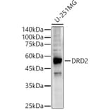 Western Blot - Anti-Dopamine D2 Receptor Antibody (A90425) - Antibodies.com