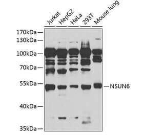 Western Blot - Anti-NSUN6 Antibody (A90426) - Antibodies.com