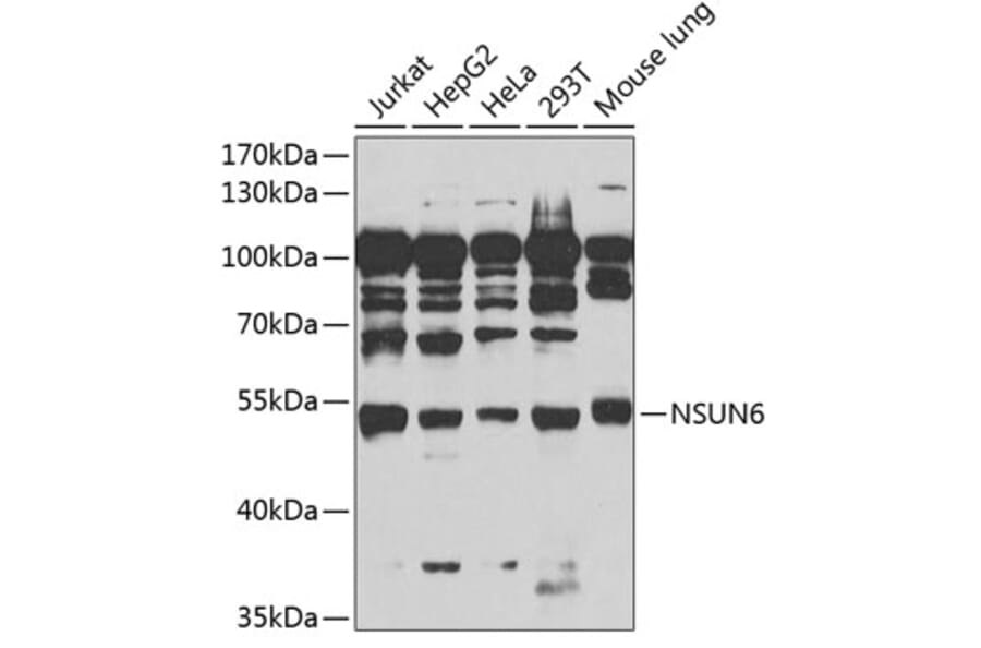 Western Blot - Anti-NSUN6 Antibody (A90426) - Antibodies.com