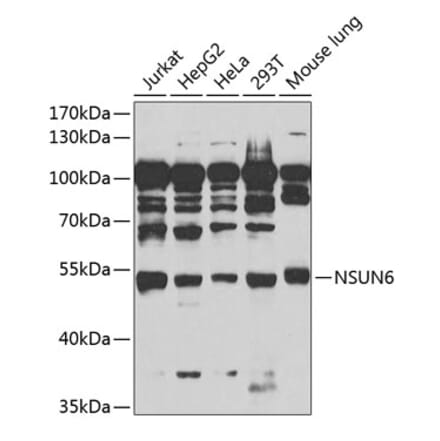 Western Blot - Anti-NSUN6 Antibody (A90426) - Antibodies.com