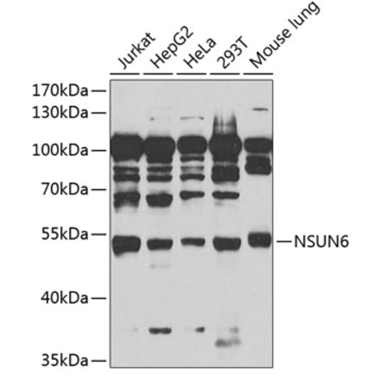 Western Blot - Anti-NSUN6 Antibody (A90426) - Antibodies.com