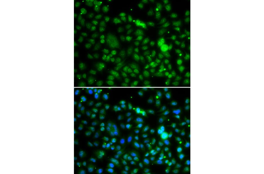 Immunofluorescence - Anti-NSUN6 Antibody (A90426) - Antibodies.com