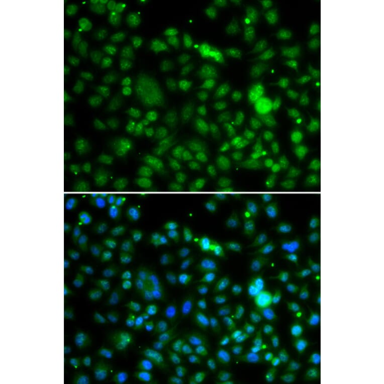 Immunofluorescence - Anti-NSUN6 Antibody (A90426) - Antibodies.com