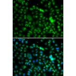 Immunofluorescence - Anti-NSUN6 Antibody (A90426) - Antibodies.com
