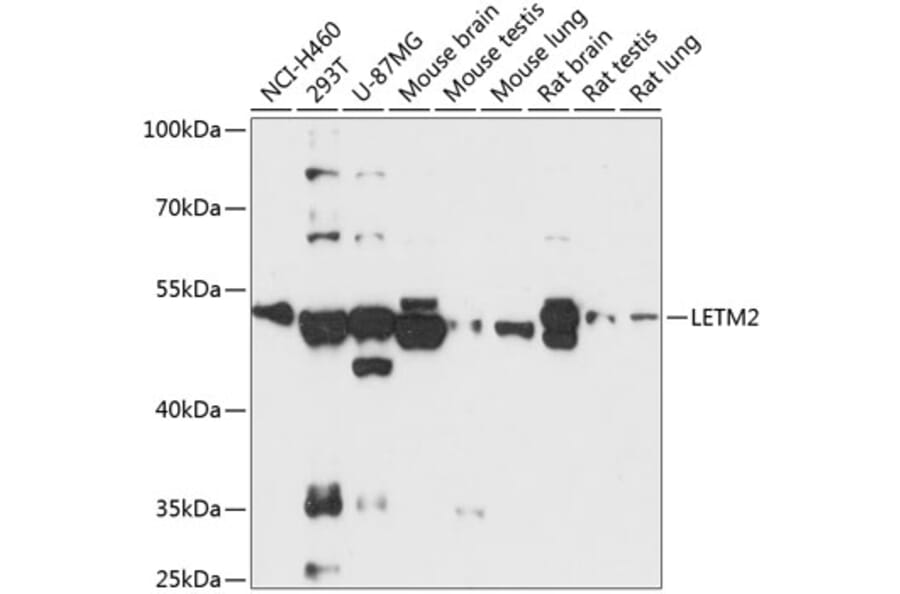 Western Blot - Anti-LETM2 Antibody (A90427) - Antibodies.com