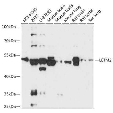 Western Blot - Anti-LETM2 Antibody (A90427) - Antibodies.com