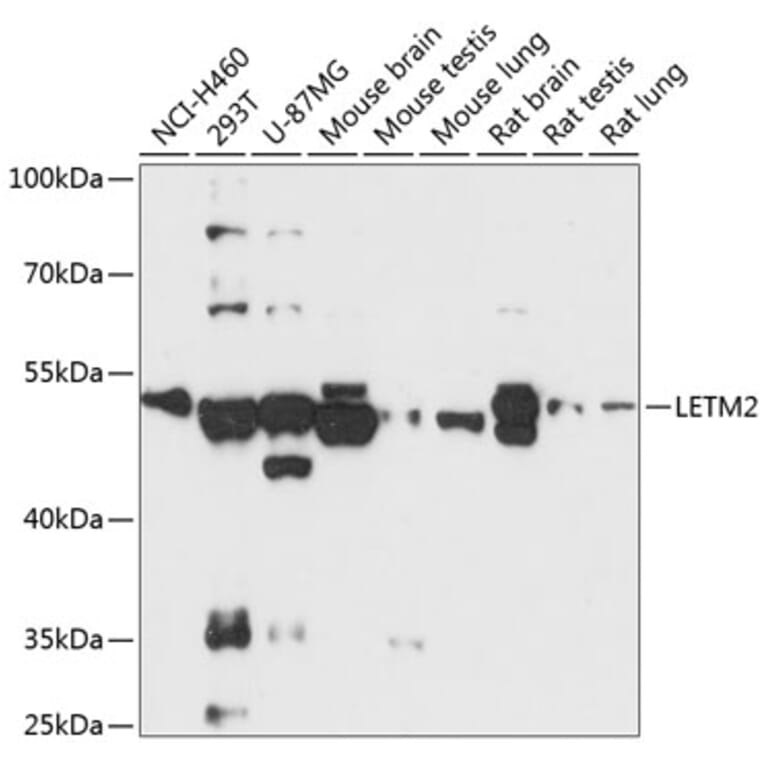 Western Blot - Anti-LETM2 Antibody (A90427) - Antibodies.com