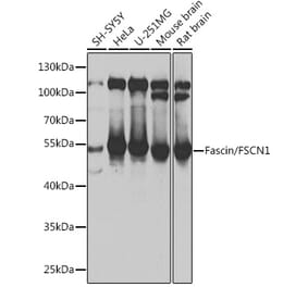 Western Blot - Anti-Fascin Antibody (A90428) - Antibodies.com