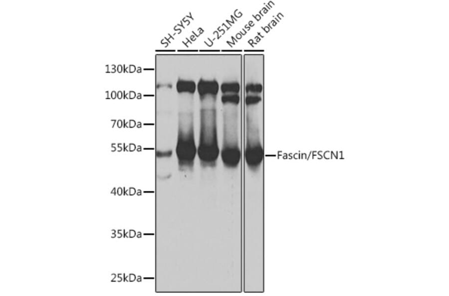 Western Blot - Anti-Fascin Antibody (A90428) - Antibodies.com
