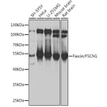 Western Blot - Anti-Fascin Antibody (A90428) - Antibodies.com