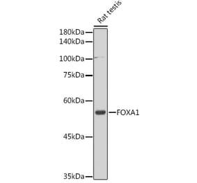 Western Blot - Anti-FOXA1 Antibody (A90429) - Antibodies.com