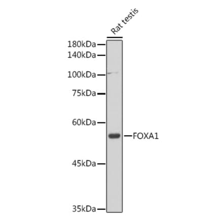 Western Blot - Anti-FOXA1 Antibody (A90429) - Antibodies.com