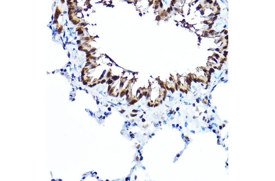 Immunohistochemistry - Anti-FOXA1 Antibody (A90429) - Antibodies.com