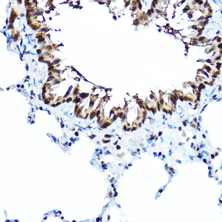Immunohistochemistry - Anti-FOXA1 Antibody (A90429) - Antibodies.com