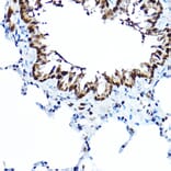 Immunohistochemistry - Anti-FOXA1 Antibody (A90429) - Antibodies.com