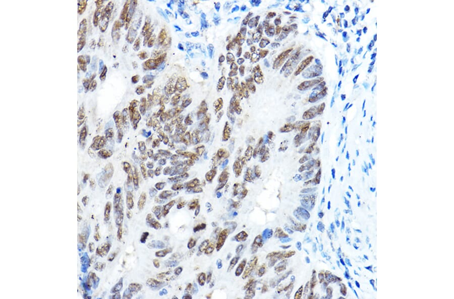 Immunohistochemistry - Anti-FOXA1 Antibody (A90429) - Antibodies.com