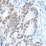 Immunohistochemistry - Anti-FOXA1 Antibody (A90429) - Antibodies.com