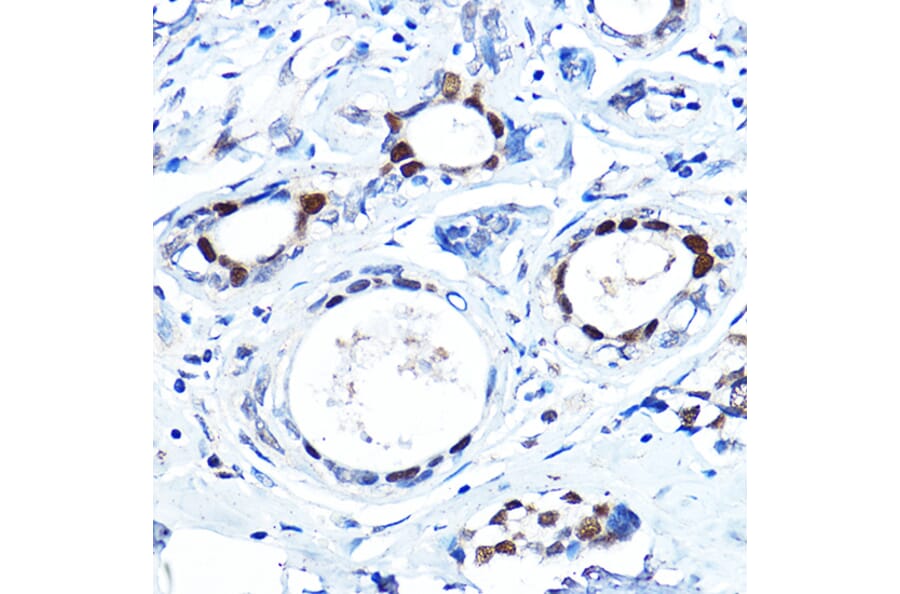Immunohistochemistry - Anti-FOXA1 Antibody (A90429) - Antibodies.com