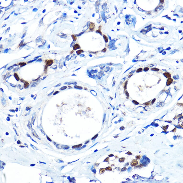 Immunohistochemistry - Anti-FOXA1 Antibody (A90429) - Antibodies.com