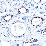 Immunohistochemistry - Anti-FOXA1 Antibody (A90429) - Antibodies.com