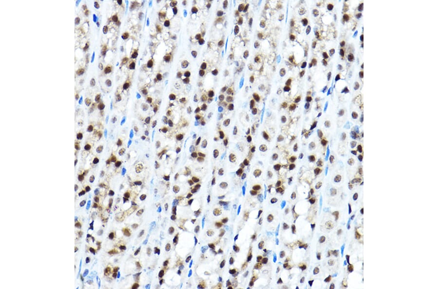Immunohistochemistry - Anti-FOXA1 Antibody (A90429) - Antibodies.com