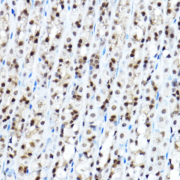 Immunohistochemistry - Anti-FOXA1 Antibody (A90429) - Antibodies.com
