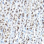 Immunohistochemistry - Anti-FOXA1 Antibody (A90429) - Antibodies.com