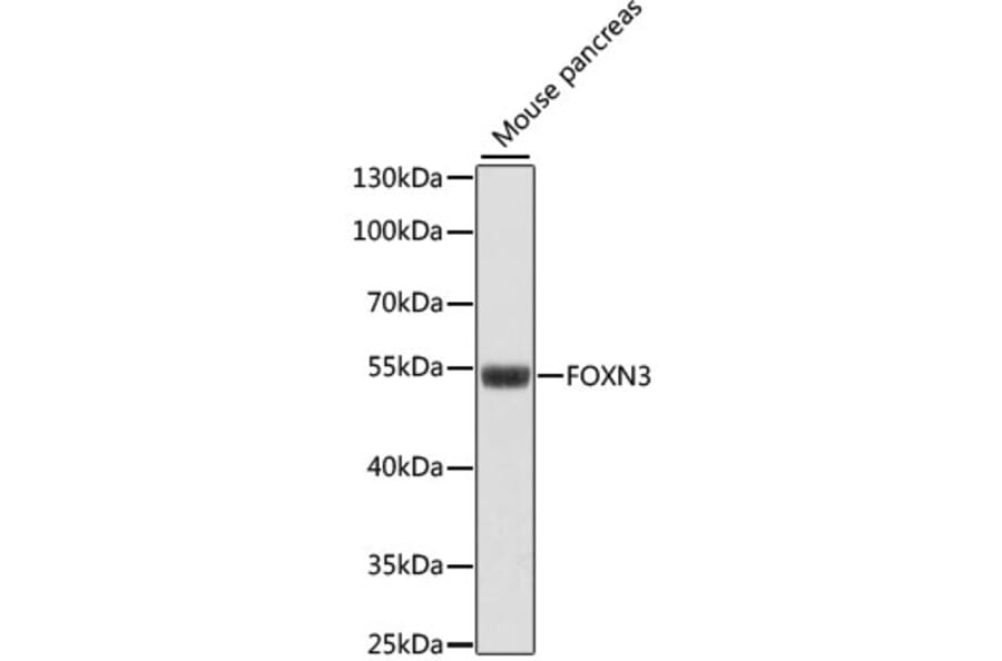 Western Blot - Anti-FOXN3 Antibody (A90430) - Antibodies.com