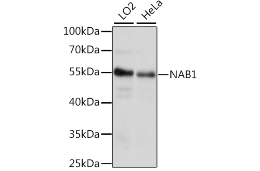 Western Blot - Anti-NAB1 Antibody (A90431) - Antibodies.com