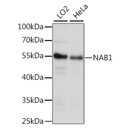 Western Blot - Anti-NAB1 Antibody (A90431) - Antibodies.com