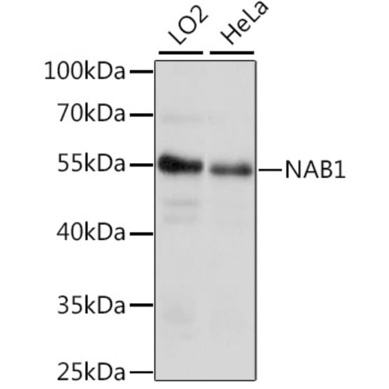 Western Blot - Anti-NAB1 Antibody (A90431) - Antibodies.com
