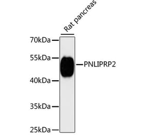 Western Blot - Anti-PNLIPRP2 Antibody (A90432) - Antibodies.com