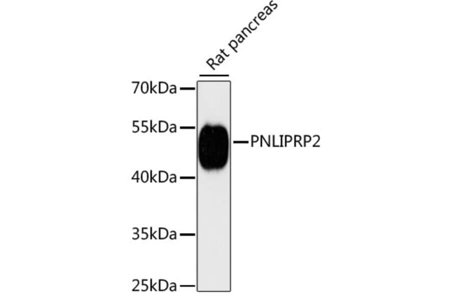 Western Blot - Anti-PNLIPRP2 Antibody (A90432) - Antibodies.com