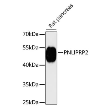 Western Blot - Anti-PNLIPRP2 Antibody (A90432) - Antibodies.com