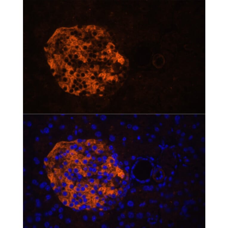 Immunofluorescence - Anti-PNLIPRP2 Antibody (A90432) - Antibodies.com
