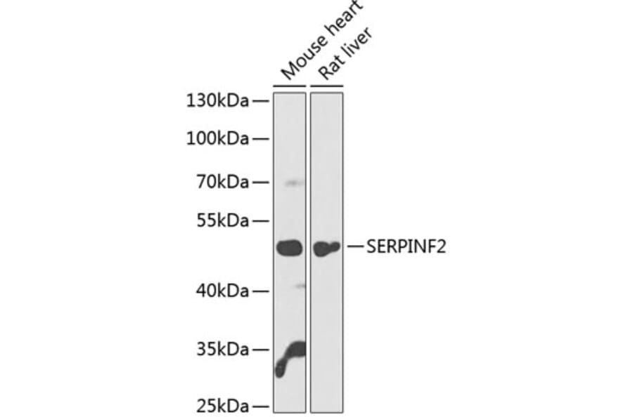 Western Blot - Anti-alpha 2 Antiplasmin Antibody (A90433) - Antibodies.com