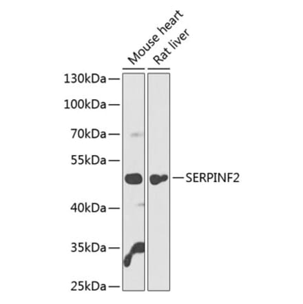 Western Blot - Anti-alpha 2 Antiplasmin Antibody (A90433) - Antibodies.com