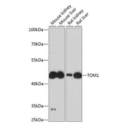 Western Blot - Anti-TOM1 Antibody (A90434) - Antibodies.com