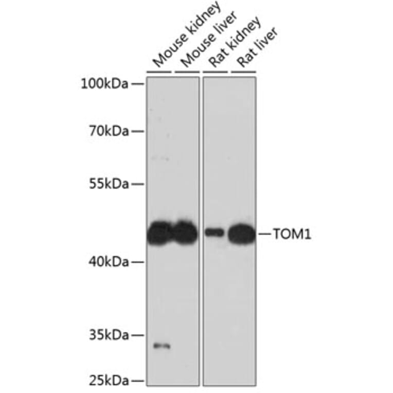 Western Blot - Anti-TOM1 Antibody (A90434) - Antibodies.com