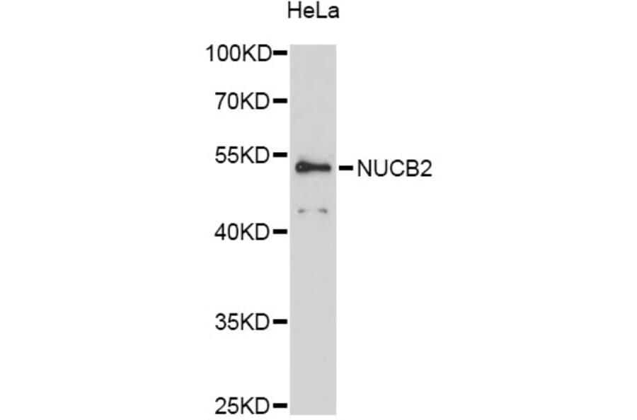 Western Blot - Anti-NUCB2 Antibody (A12642) - Antibodies.com