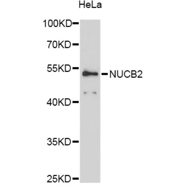 Western Blot - Anti-NUCB2 Antibody (A12642) - Antibodies.com
