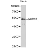 Western Blot - Anti-NUCB2 Antibody (A12642) - Antibodies.com