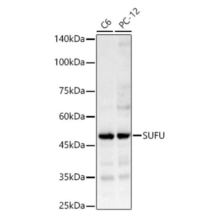 Western Blot - Anti-SUFU Antibody (A90436) - Antibodies.com