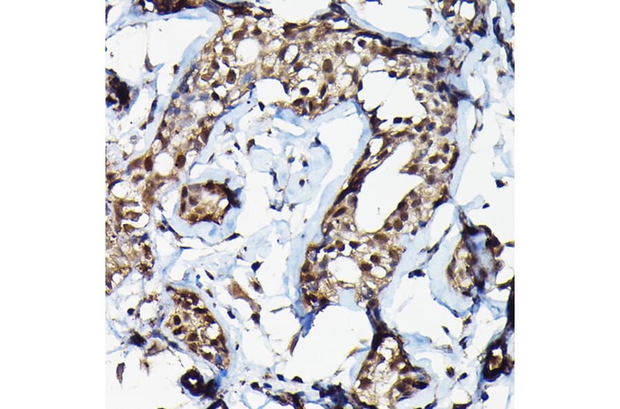 Immunohistochemistry - Anti-SUFU Antibody (A90436) - Antibodies.com